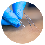 Fisioterapia Invasiva